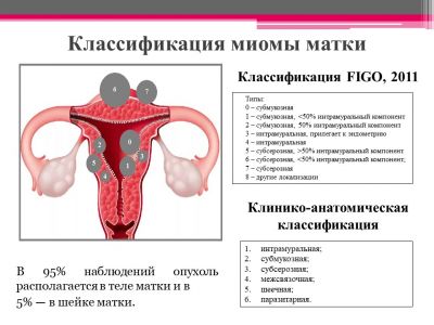 Размеры миомы матки. Миома матки Figo. Миома матки Figo 5. Figo 4 Тип миома матки. Figo 7 миома матки.