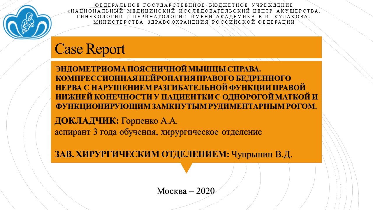 Эндометриома поясничной мышцы справа. Компрессионная нейропатия правого ...