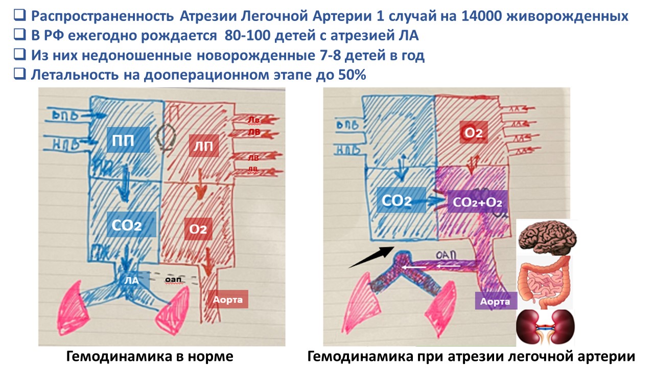 Атрезия легочной артерии тест нмо с ответами