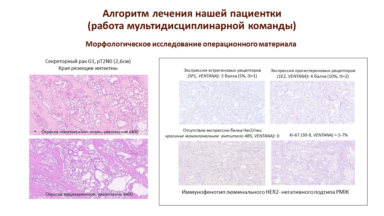 Секреторный рак молочной железы у беременной пациентки: особенности  диагностики и лечения » Акушерство и Гинекология